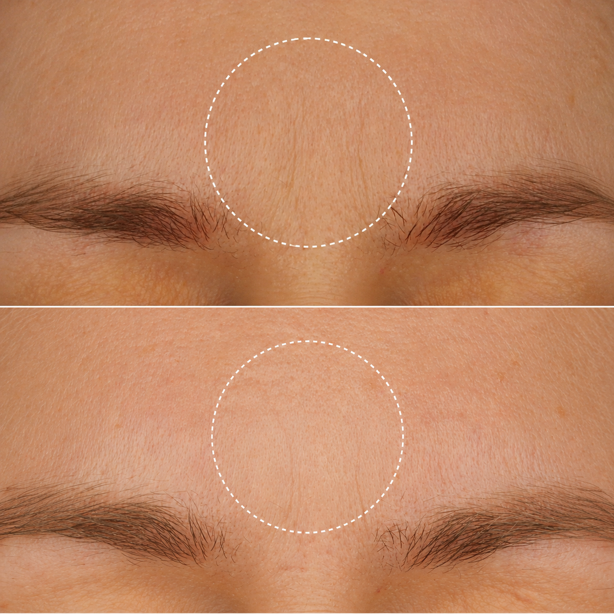Glow Up Retinol Alternative Anti Rimpel Crème