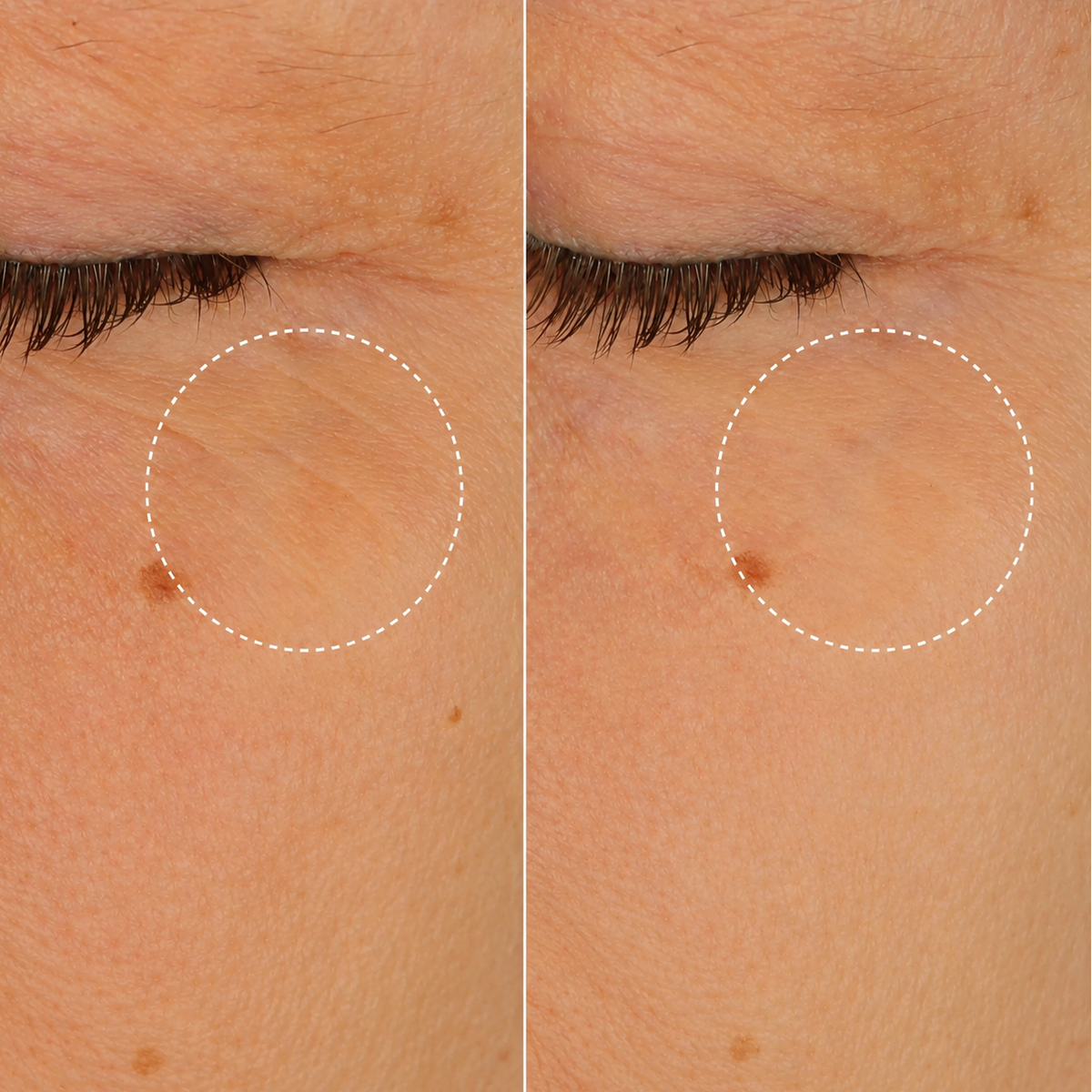 Glow Up Retinol Alternative Anti-Rimpel Eye Serum