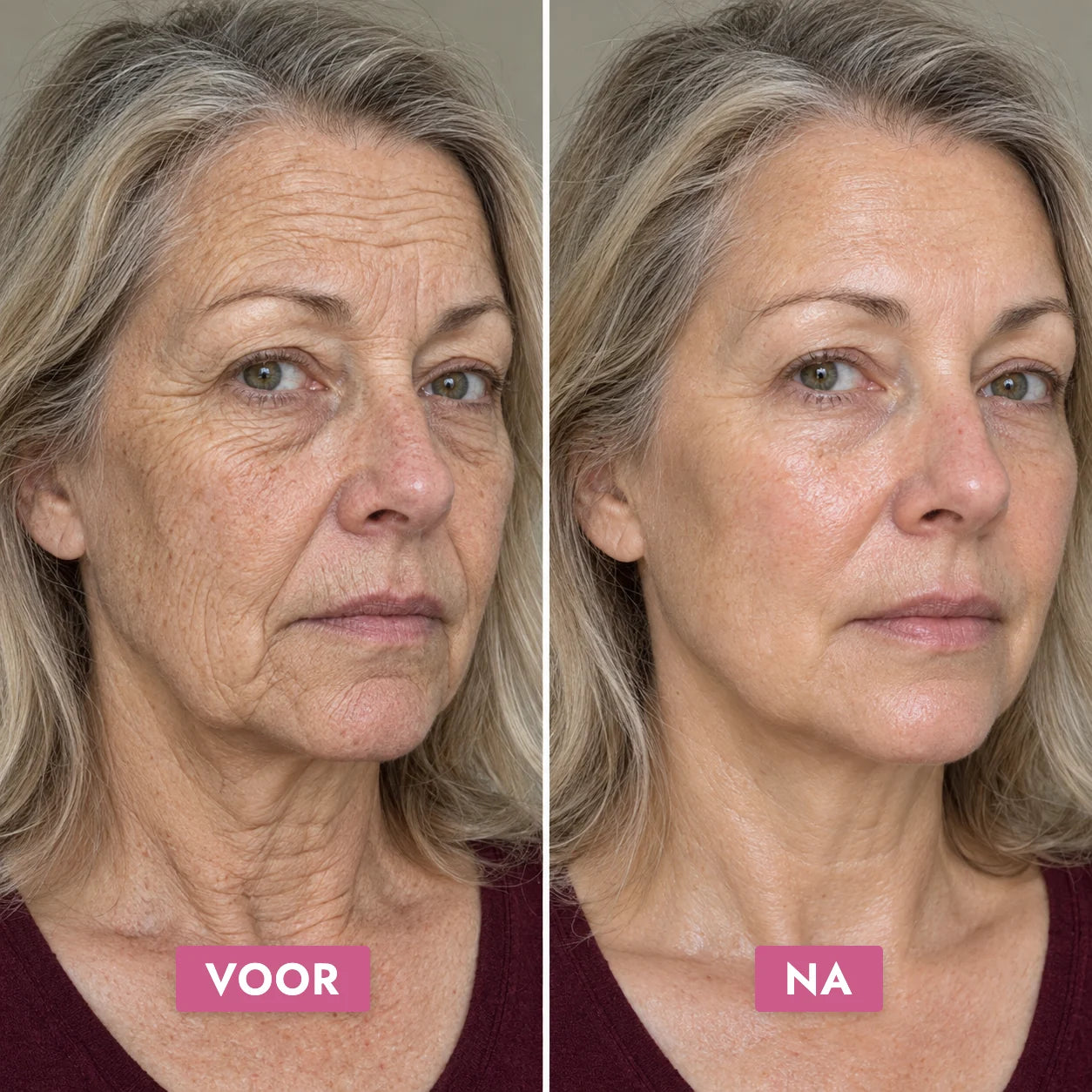 Voor en na: gezicht en hals