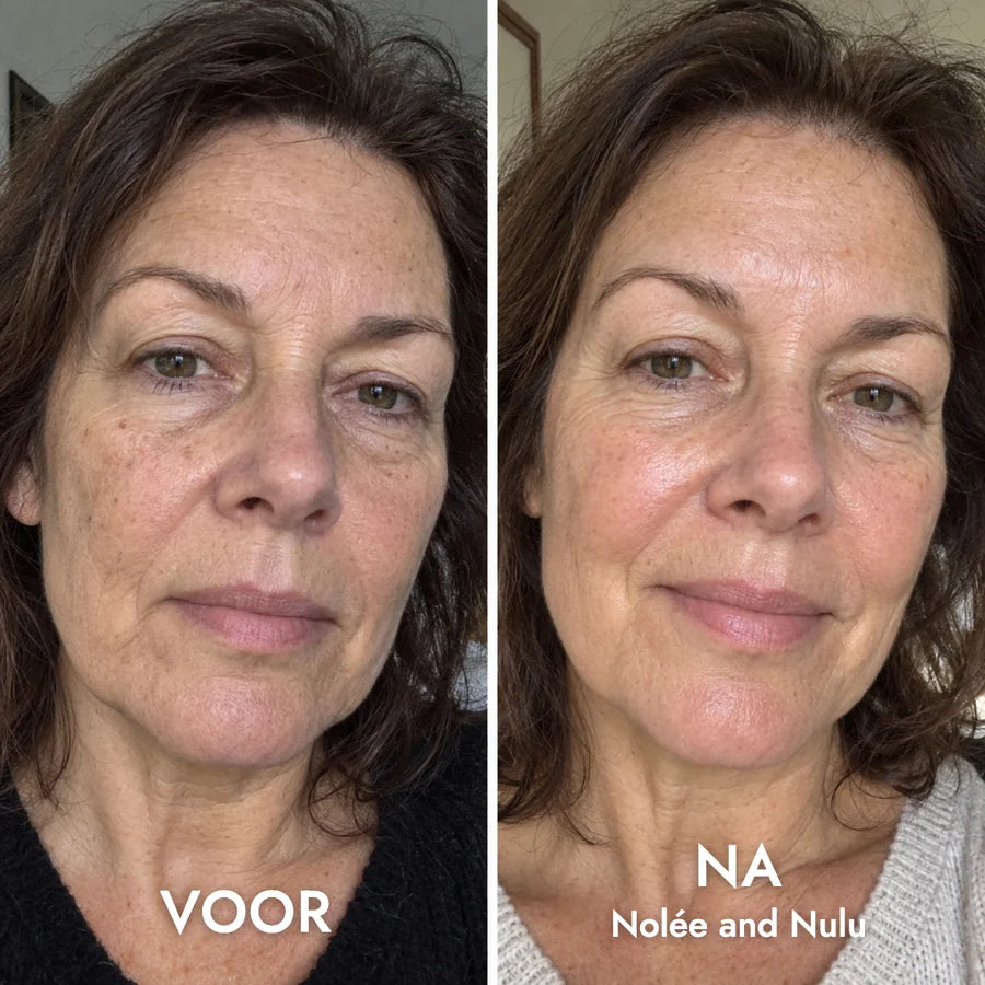 Voor en na: Ellen, 58