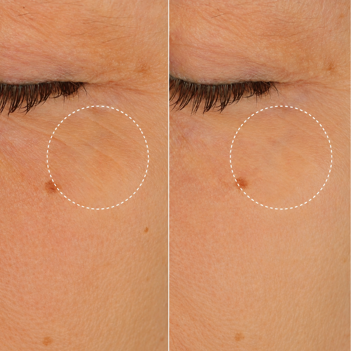 Glow Up Retinol Alternative Anti-Rimpel Eye Serum