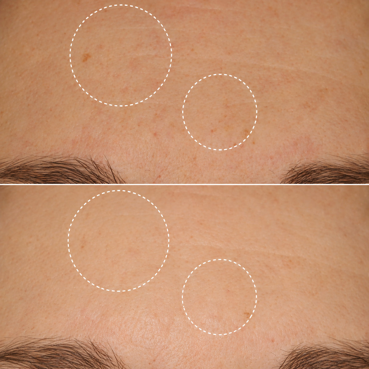 Huid Verstevigend Retinol Alternative Serum