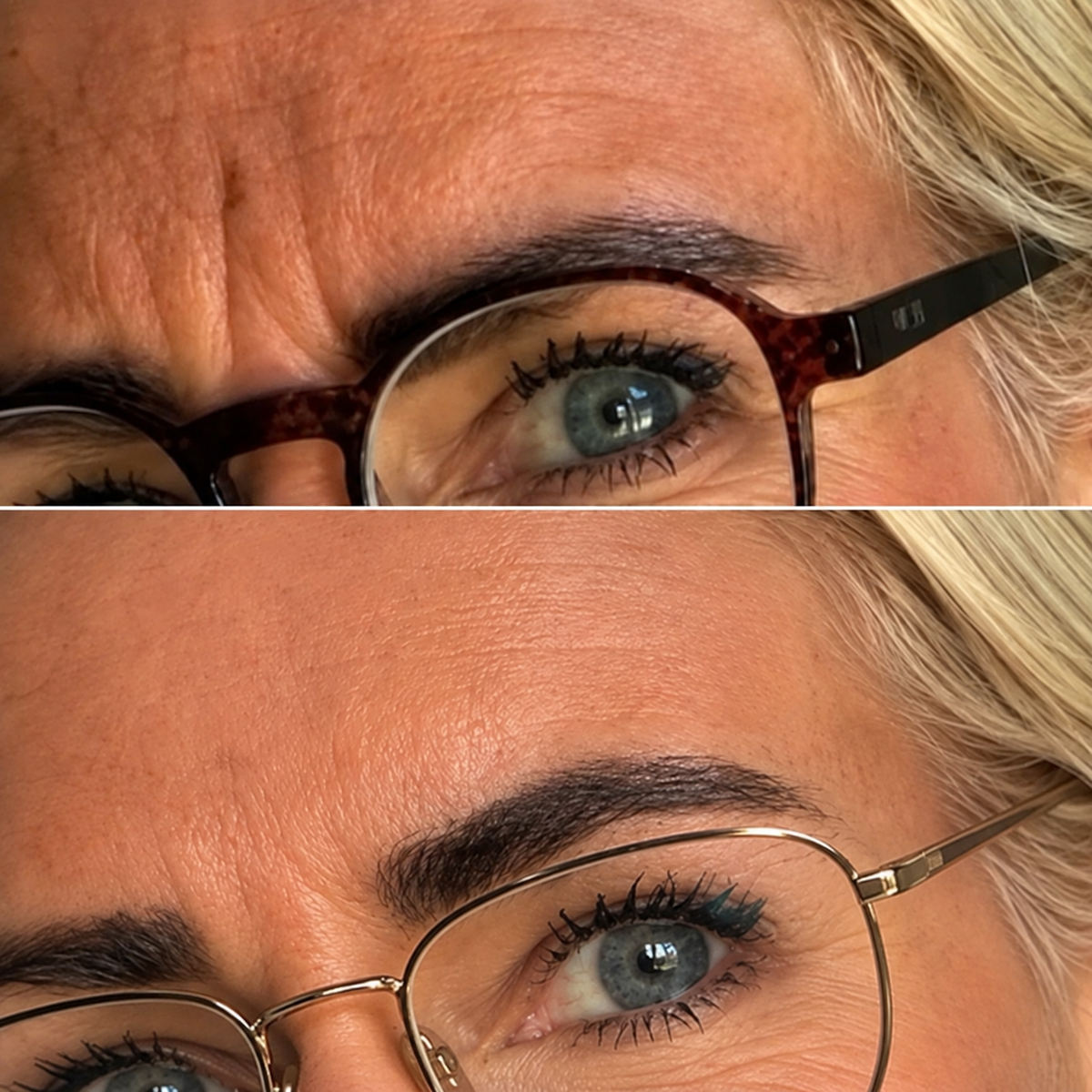 Huidverbeterende Bakuchiol oil serum