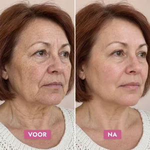 Retinol Alternative Crème — voor en na
