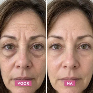 Retinol Alternative Eye Serum — voor en na