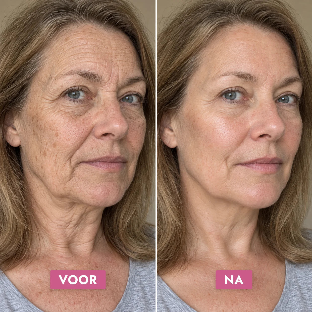 Retinol Alternative Serum — voor en na