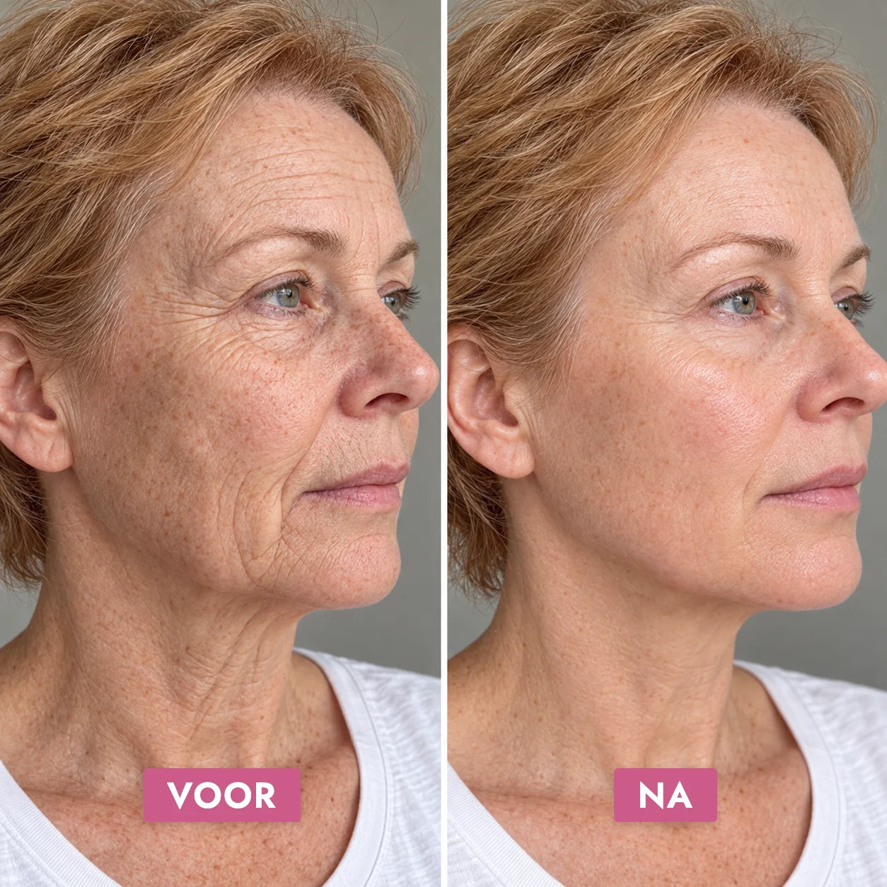 Radiant Glow Duo — voor en na