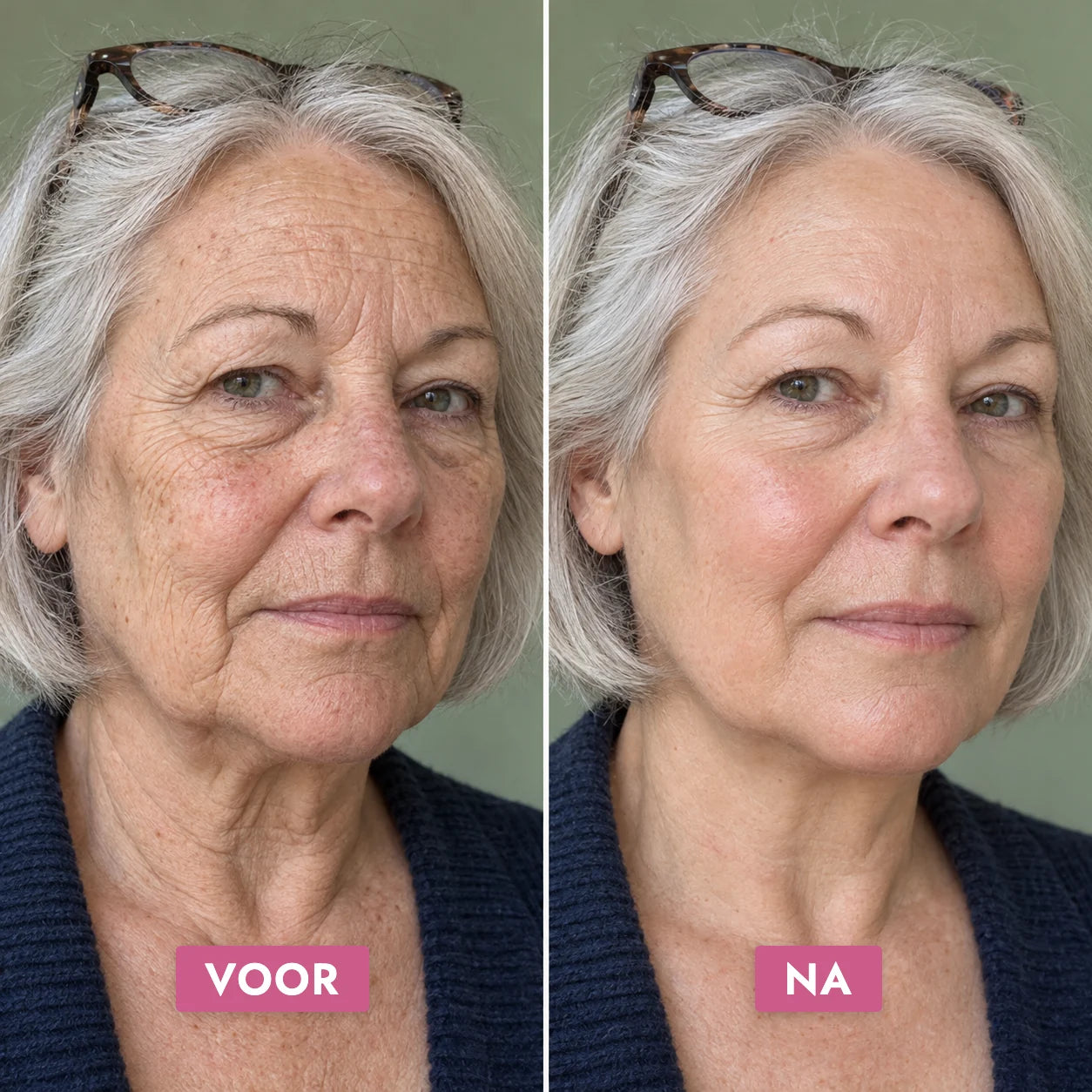 Daily Glow Set — voor en na