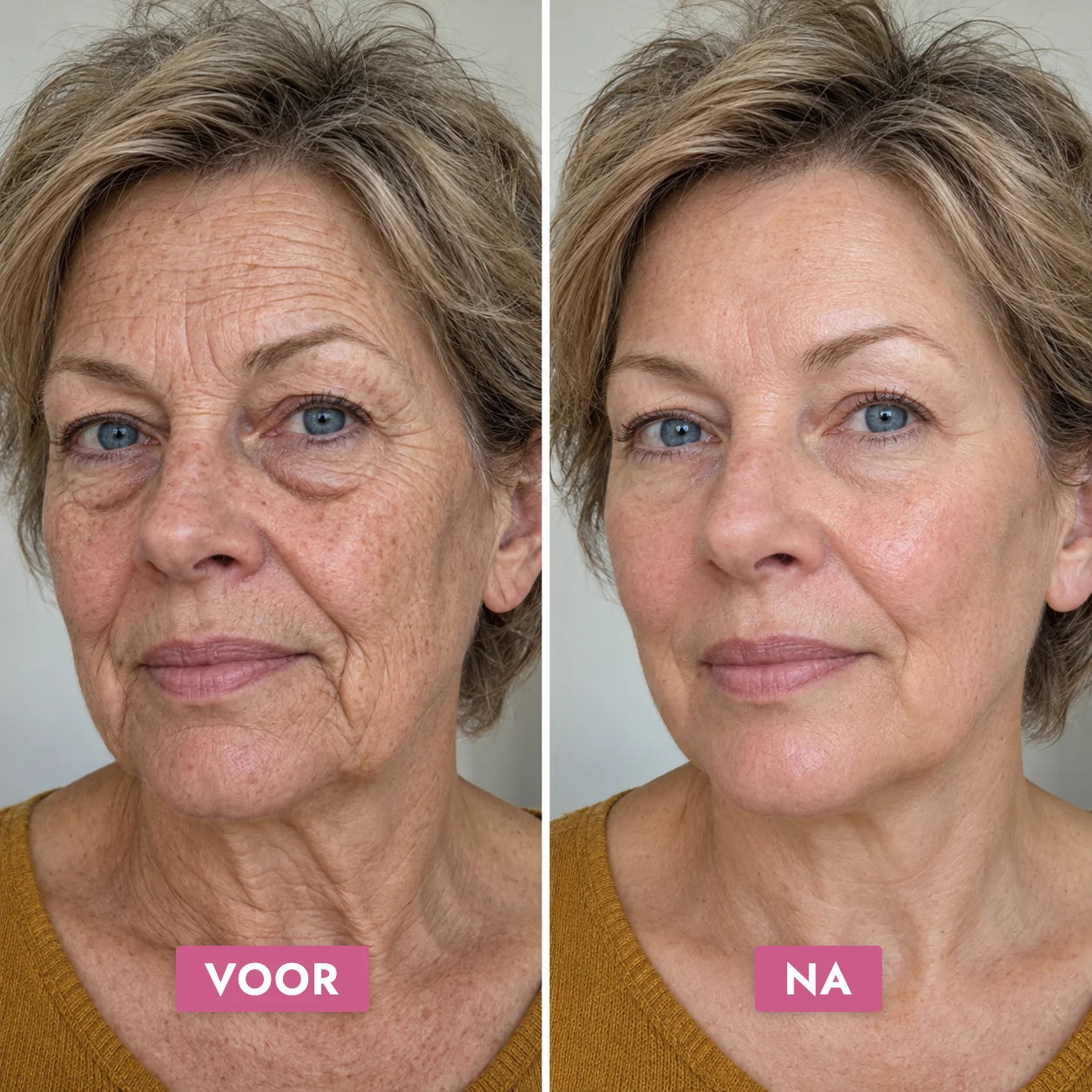 Complete Glow Bundle — voor en na