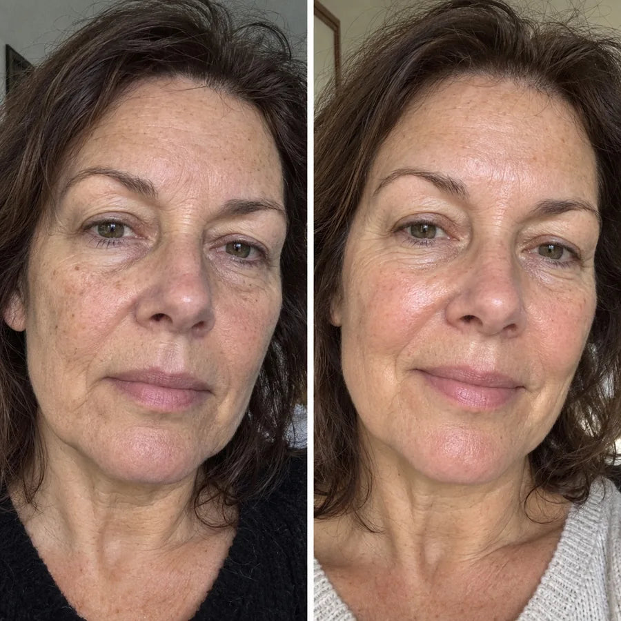 Voor en na: Monique, 56
