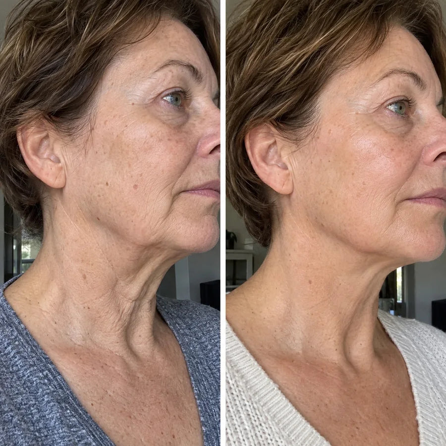Voor en na: Karin, 59
