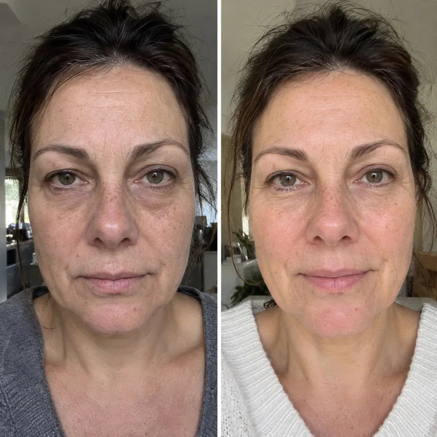 Voor en na: Wendy, 55