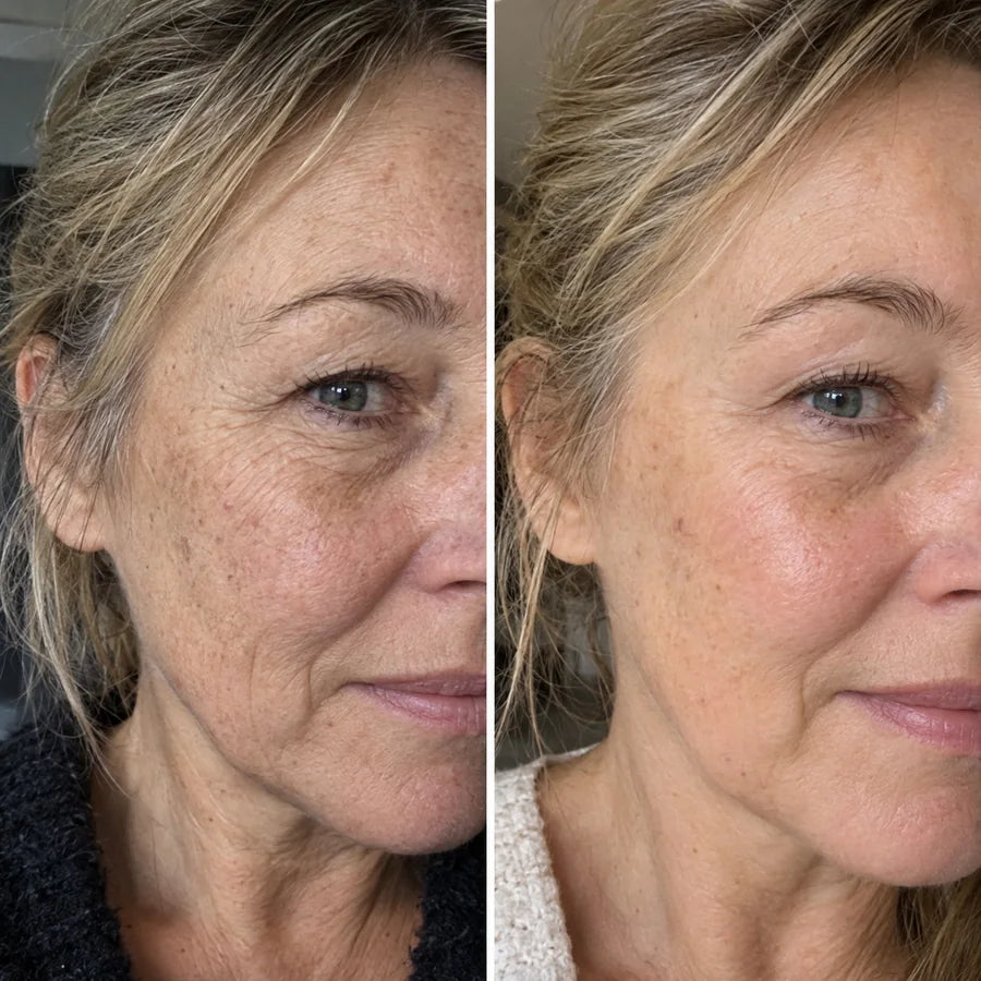Voor en na: Petra, 57