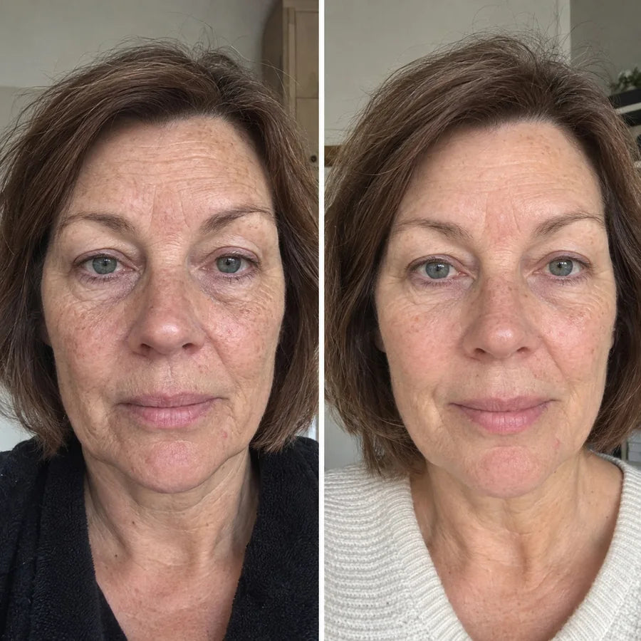 Voor en na: Yvonne, 55