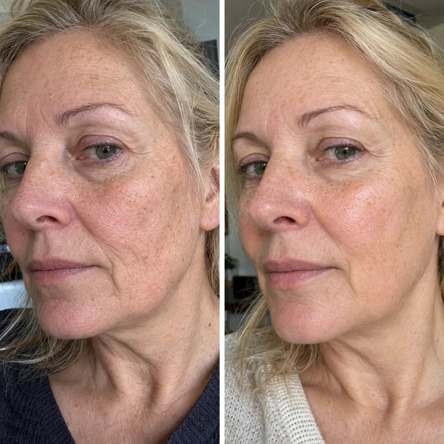 Voor en na: Hanneke, 61