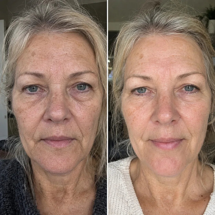 Voor en na: Ingrid, 58
