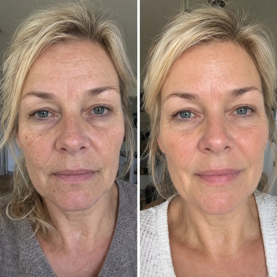 Voor en na: Bianca, 53