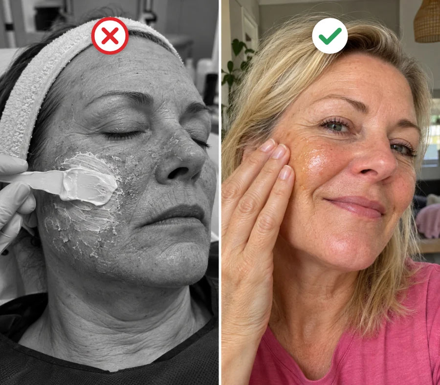 Retinol tegenover het Bakuchiol Oil Serum